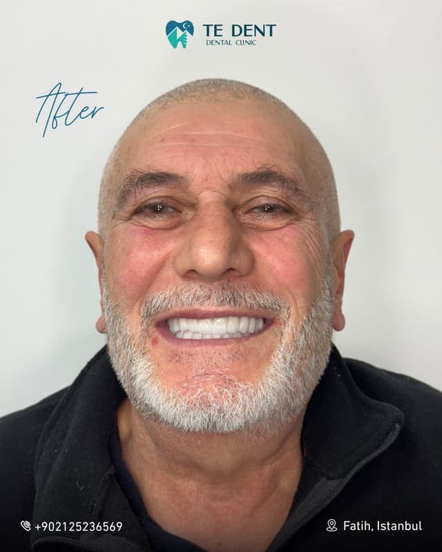 General dentistry — after treatment