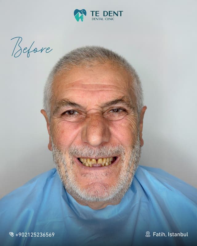 General dentistry — before treatment